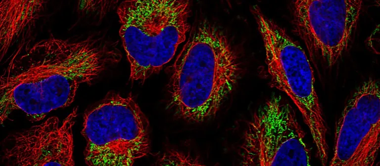 A confocal immunofluorescence image of the kind players classified - blue cell nuclei, red microtubules, and a green-stained protein of interest
